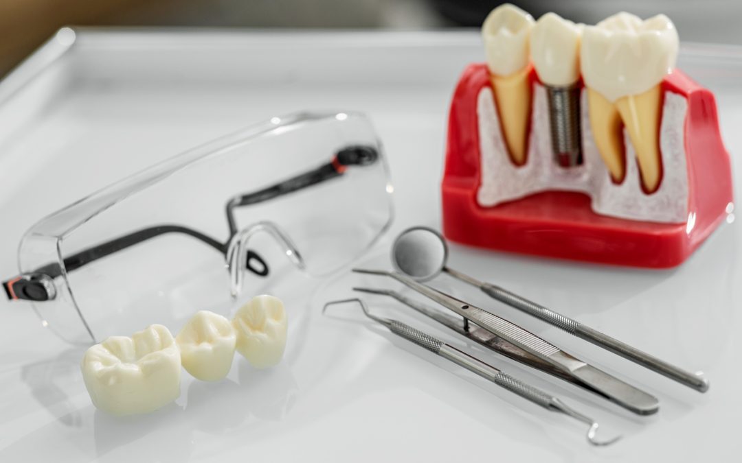 Dental Implants vs. Dental Bridges: Which Restores Your Smile Better in Prairieville, LA?